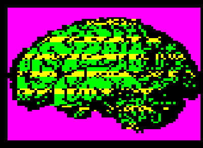 Brain by Max Capacity